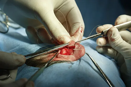 Ear Reshaping Surgery